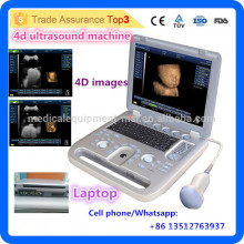 MSLCU18i Good resolution!! portable 4d ultrasound/cheapest 4d ultrasound machine with 4d volume probe